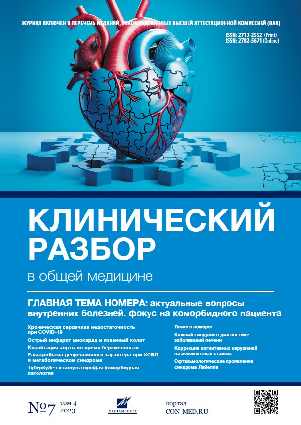 Vol 4, №7 (2023)